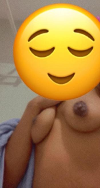 Red, 25  female escort, Albany